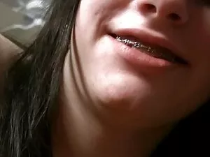 თვალები კონდომის ლობ ...